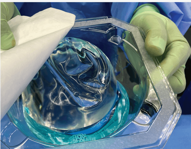 Copper-Iodine Pocket Irrigation: 20-Patient Safety Study